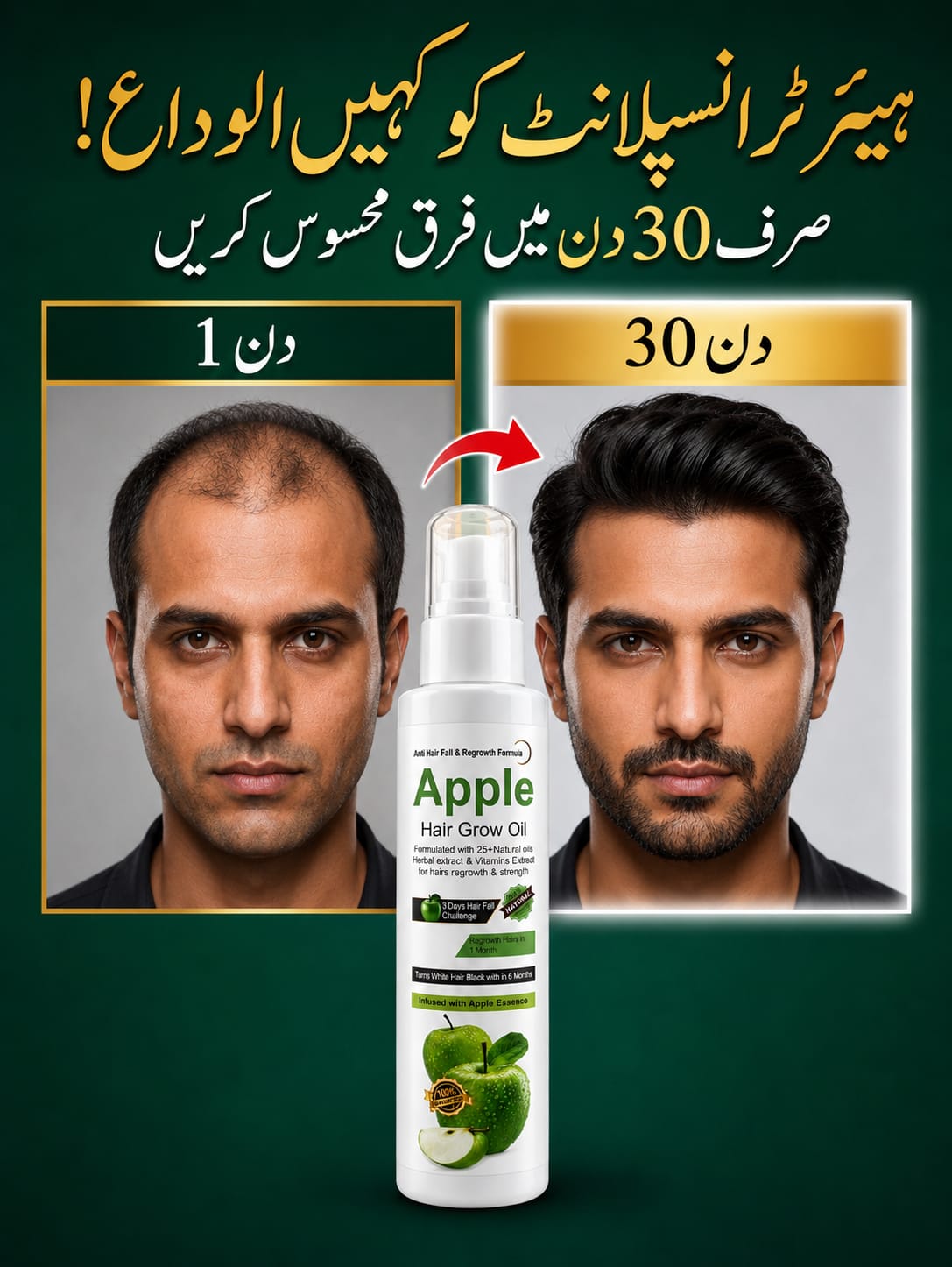 Apple Hair Grow Oil